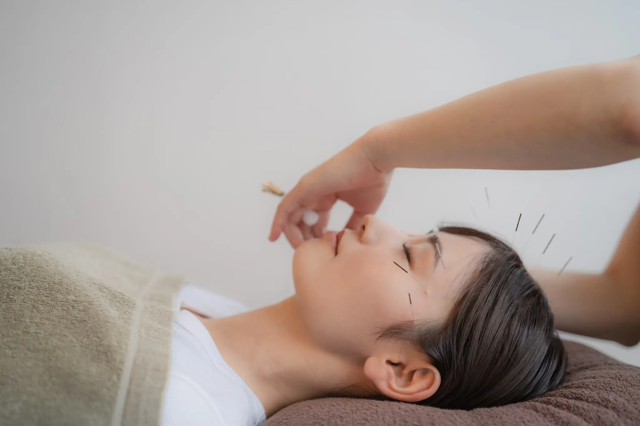 美容鍼の施術風景・イメージ